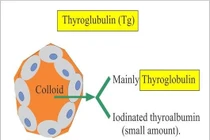  Anti-Thyroglobulin tăng có phải ung thư?