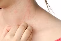 Thành phần gây dị ứng trong thức ăn