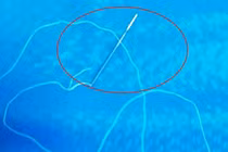 Kinh hãi cảnh bé 12 tuổi nuốt kim khâu, sợi cước dài 30cm vào bụng