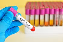 Hà Nội: công khai giá dịch vụ xét nghiệm và xử lý nghiêm vi phạm