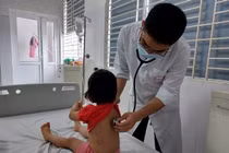 Hà Nội: Bệnh nhân cúm A tăng bất thường