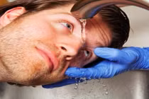  Mất thị lực vì chủ quan khi thuốc nhuộm tóc vào mắt