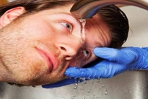  Mất thị lực vì chủ quan khi thuốc nhuộm tóc vào mắt