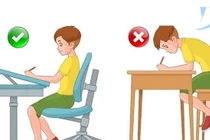 Gù lưng do ngồi máy tính nhiều