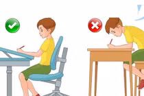 Gù lưng do ngồi máy tính nhiều