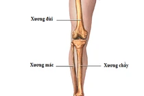 Sốc sau chấn thương cẳng chân
