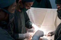 Bé gái 14 tuổi bị tắc ruột do ăn nhiều quả hồng ngâm