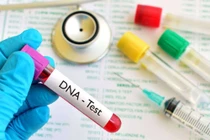 Nên đi xét nghiệm ADN ở đâu?        