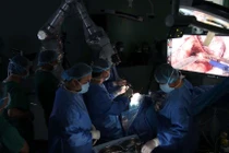 Cánh tay robot cắt u não lập kỷ lục