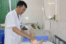 Chân co rút, biến dạng vì thoái hóa khớp