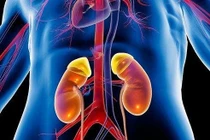 5 dấu hiệu suy thận cấp điển hình bạn không thể bỏ qua