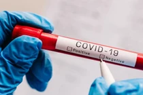 Một người đàn ông Hà Lan bị cáo buộc bán coronavirus 