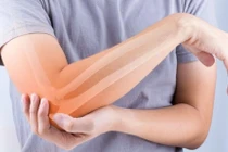 Điều trị viêm khớp và viêm khớp dạng thấp mùa lạnh 