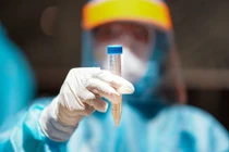 Nữ nhân viên ngân hàng ở TP Hải Dương dương tính với nCoV