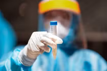 Nữ nhân viên ngân hàng ở TP Hải Dương dương tính với nCoV