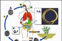 Nhiễm giun đũa gây nhiều bệnh nguy hiểm
