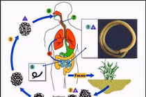 Nhiễm giun đũa gây nhiều bệnh nguy hiểm