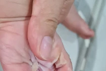 TPHCM: Thanh tra Sở Y tế làm việc với Bệnh viện FV về vụ tai biến sản khoa 