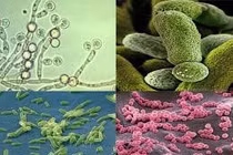  Dùng vi sinh vật xử lý nước