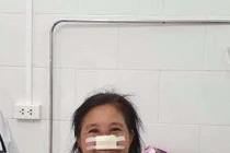 Bệnh nhân whitmore tổn thương mũi trong y văn thế giới chưa đề cập 