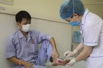 Nhiễm trùng nặng do được thầy lang chữa bỏng bằng lông gà trộn thuốc 