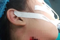 Gia tăng trẻ nghỉ học ở nhà gặp tai nạn