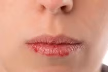 Nhìn miệng đoán bệnh