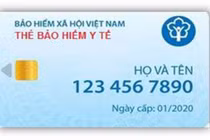 Tháng 1/2020 dùng thẻ BHYT điện tử, nhận diện người bệnh bằng khuôn mặt