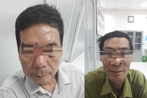 Phát hiện mắc ung thư sau khi đi tẩy nốt ruồi