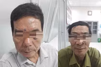 Phát hiện mắc ung thư sau khi đi tẩy nốt ruồi