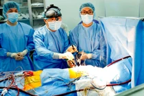Xây dựng quy trình chuẩn phẫu thuật nội soi tim trên cả nước