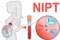 Làm NIPT, Double Test, Triple Test chẩn đoán dị tật thai nhi