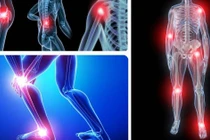 Đau xương khớp do thời tiết