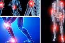 Đau xương khớp do thời tiết