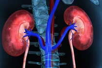 Tự ý bỏ thuốc Tây dẫn đến suy thận