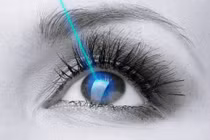 Sửa mí có phẫu thuật cận thị luôn được không?