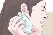 Bệnh vảy nến ở mặt: Nguyên nhân và cách cải thiện hiệu quả