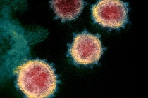 Biến chủng mới gây chú ý tại Mỹ