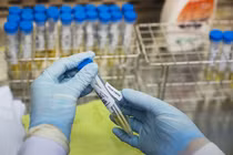 TP HCM giám sát y tế người nhập cảnh ngắn ngày như thế nào