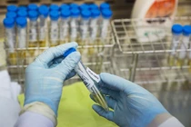 TP HCM giám sát y tế người nhập cảnh ngắn ngày như thế nào