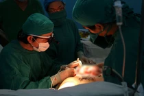 Tái tạo nhũ giúp phụ nữ mất mô tuyến vú tự tin hơn 