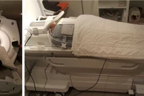 Cộng hưởng từ toàn thân tầm soát ung thư di căn