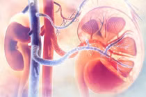 Bệnh viêm cầu thận mạn có chữa khỏi được không?