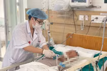 8 bệnh nhân hôn mê tổn thương não vì ngộ độc rượu chứa cồn methanol