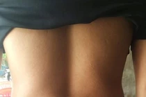 Muốn bệnh khỏi nhanh, vội vàng cấy chỉ