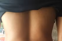 Muốn bệnh khỏi nhanh, vội vàng cấy chỉ