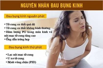 Đau bụng kinh có phải do bệnh?