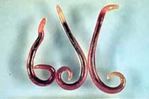 Dễ tử vong nếu nhiễm giun đầu gai