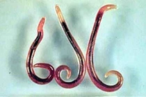 Dễ tử vong nếu nhiễm giun đầu gai