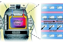  Phổi nhân tạo mới trong điều trị SARS-CoV